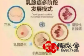 乳腺增生乳腺纤维瘤套装12.8元