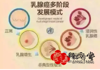 乳腺增生乳腺纤维瘤套装12.8元第1张-秘方堂