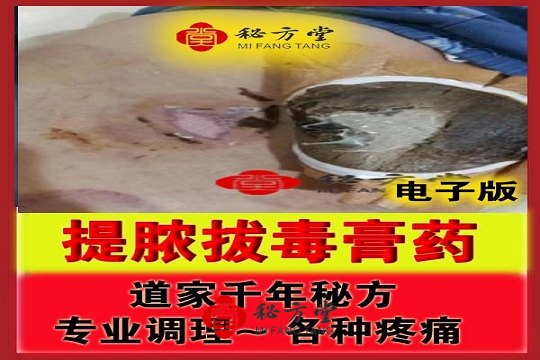 道家千年秘方提脓拔毒膏药各种疼痛克星 18米第1张-秘方堂
