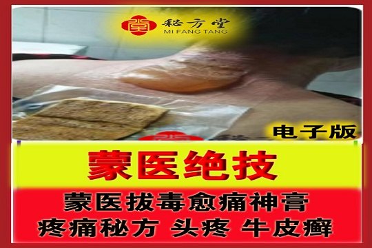 蒙医拔毒愈痛神膏 8.8元第1张-秘方堂