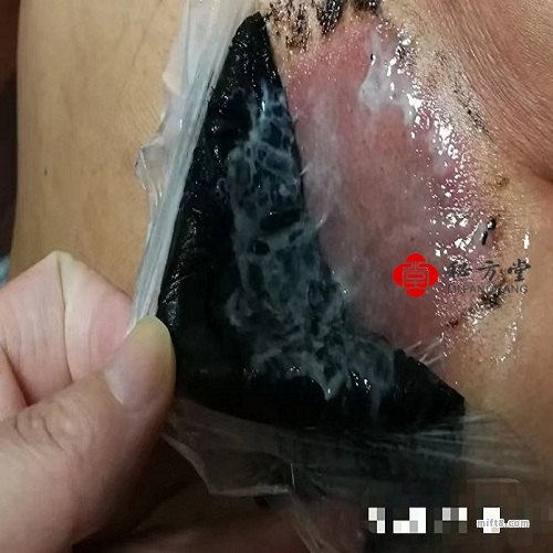 道家千年秘方提脓拔毒膏药各种疼痛克星 18元第3张-秘方堂