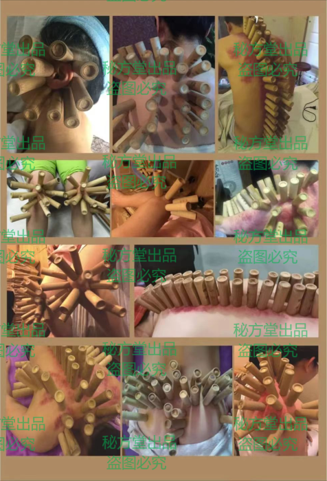 非遗水煮拇指罐水煮罐药包秘方16.8元第5张-秘方堂
