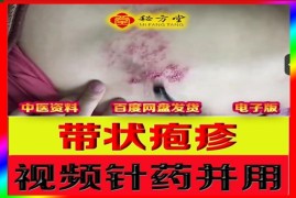 针药并用治疗带状疱疹（附赠独家文字版秘方）