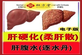 肝硬化（柔肝散），肝硬化腹水腹水秘方逐水丹8.8