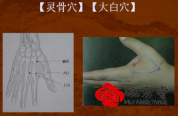 董氏奇穴心药电子书第2张-秘方堂