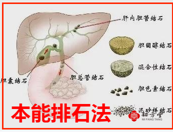 本能排石法（特效排结石秘法）8（链接已经修复））.8元第1张-秘方堂