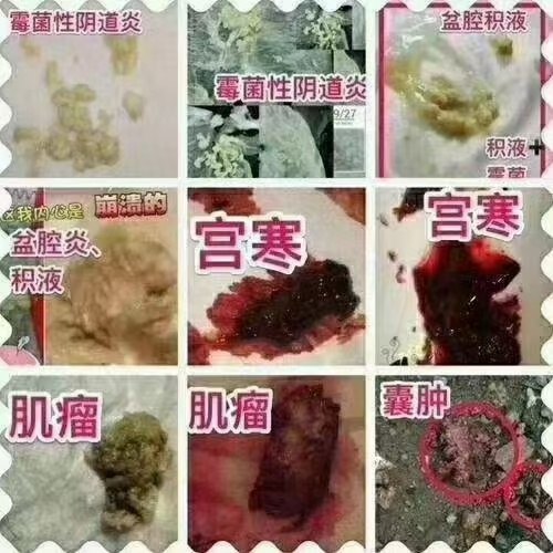 金妇康妇科专业外用水。第2张-秘方堂