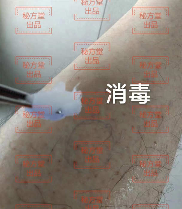 丹火炙透骨膏特效秘方土匪药秘方 十二大技术16.8元第7张-秘方堂